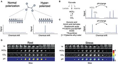 Cardiac pH-Imaging With Hyperpolarized MRI